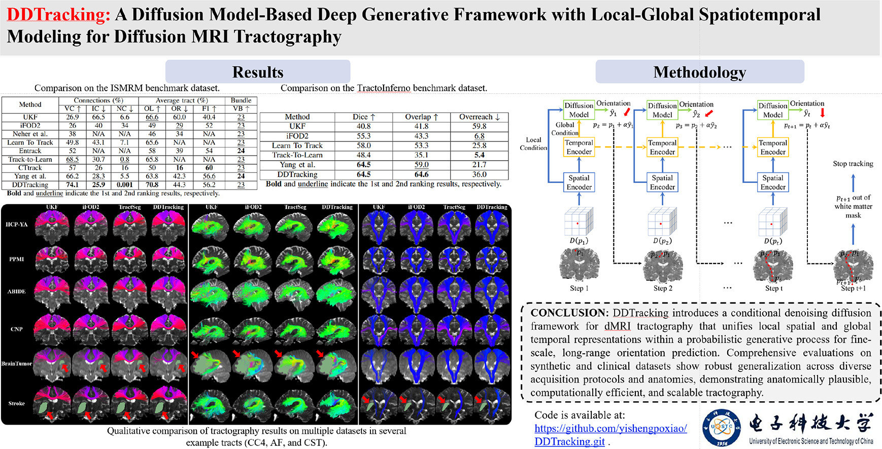 DDTracking: A Diffusion Model-Based Deep Generative Framework with Local-Global Spatiotemporal Modeling for Diffusion MRI Tractography 