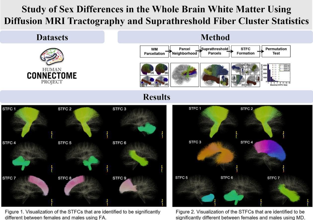 Study of Sex Differences in the Whole Brain White Matter using Diffusion MRI Tractography and Suprathreshold Fiber Cluster Statistics